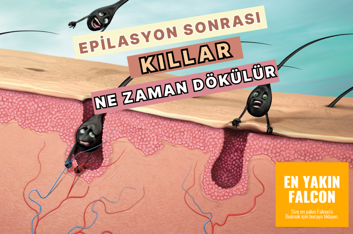 epilasyon sonrası kıllar ne zaman dökülür