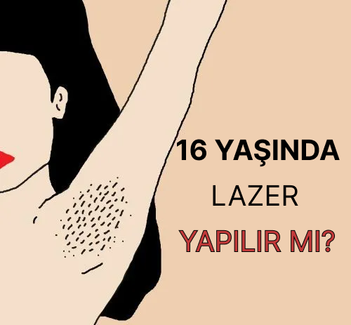 lazerde yaş sınırı